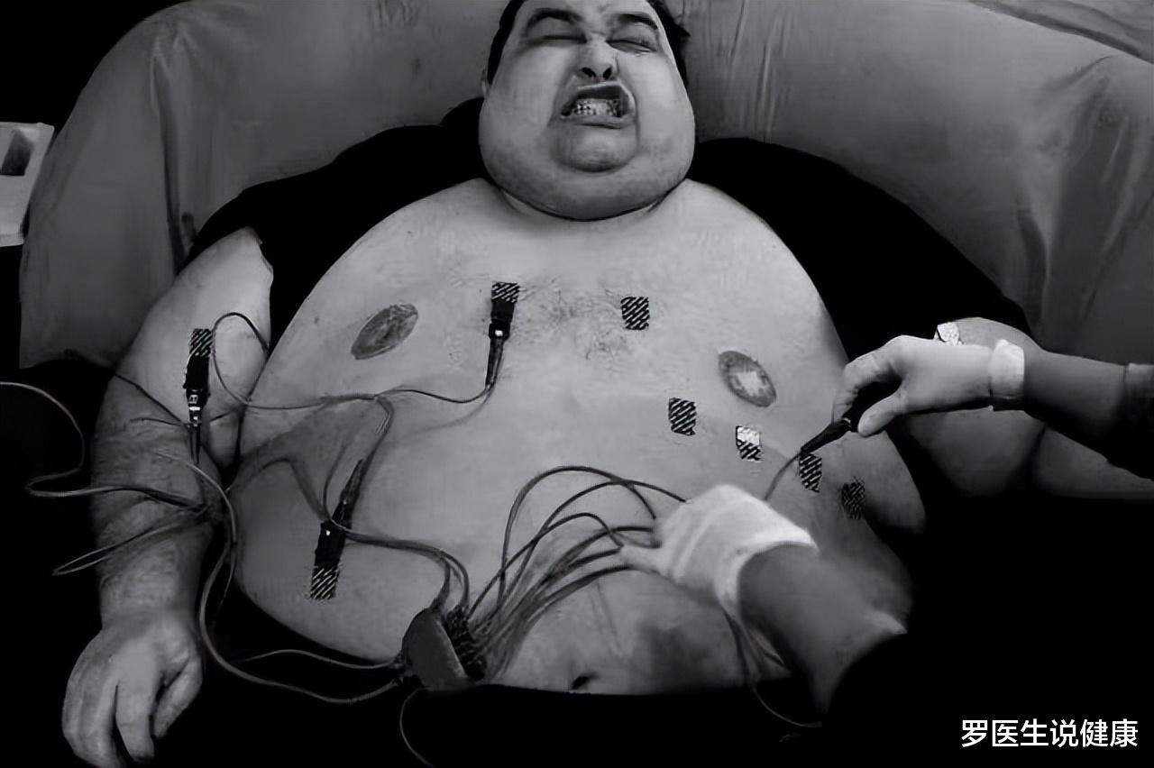 运动|511世界防治肥胖日,让你重视肥胖的危害,教你如何健康减肥