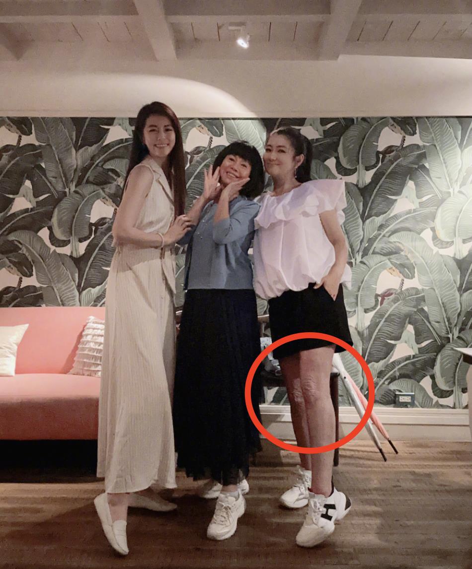 迪丽热巴|任家萱过母亲节罕见穿短裤,双腿烧伤疤痕暴露无遗