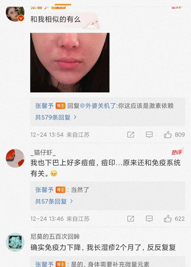 张馨予分享素颜近照，皮炎复发面部出现疤痕，透露爆发期很吓人！