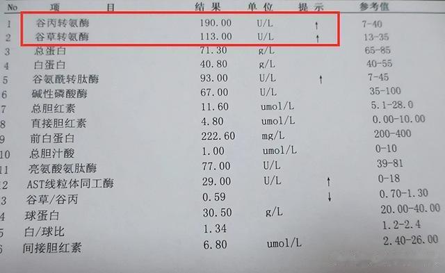 阿托伐他汀钙片虽好，但这5大禁忌症不能忽视！