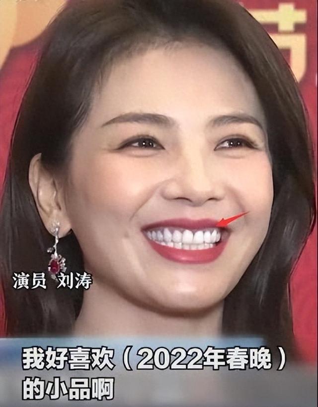 刘涛一口蓝牙上热搜,网传值300万,网友调侃:这牙能连接音响吗