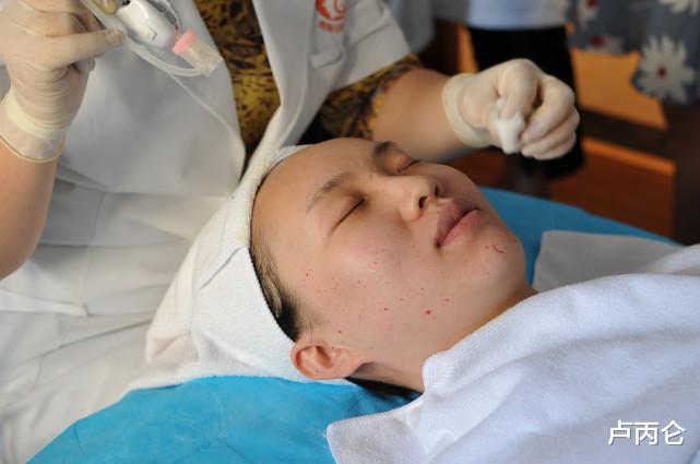 水光针不是能顶3000片面膜?为什么打完水光还要贴面膜