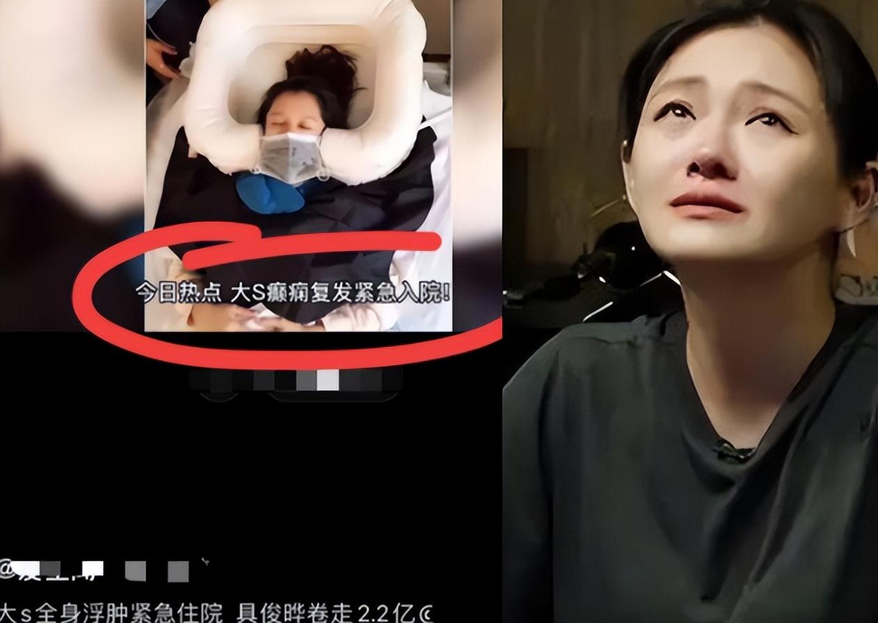 大S|报应好快!曝大S癫痫复发抢救,疑光头卷2.2亿跑路,小菲或夺回娃