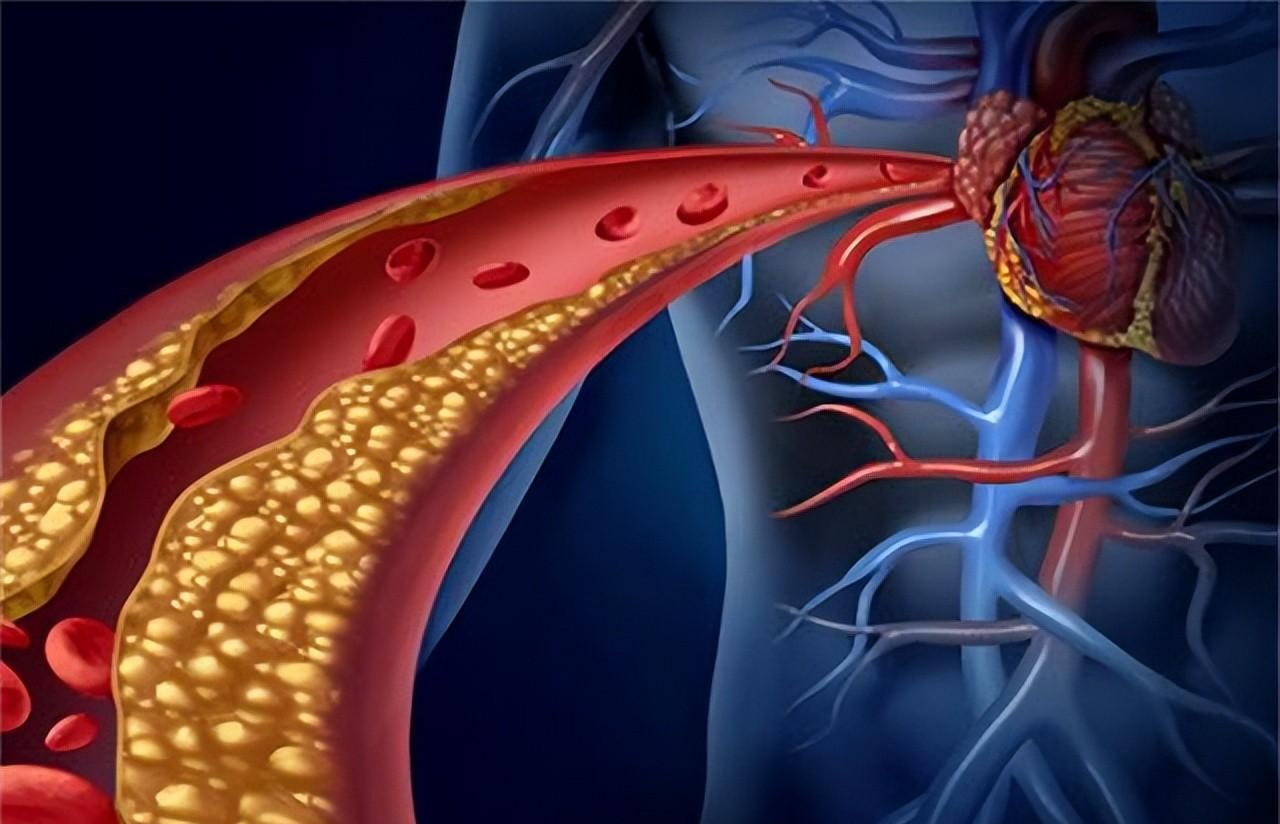 痛风|痛风了，长期喝苏打水能把尿酸降下来？医生来说清楚