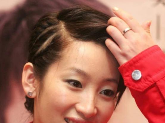 双眼皮别乱割，从景甜到戚薇，这些明星的“后遗症”出来了