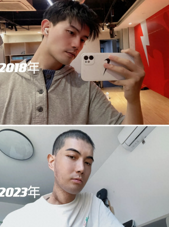 噩耗！32岁“最帅抗癌网红”龚白羊去世，移植妈妈骨髓不到两年