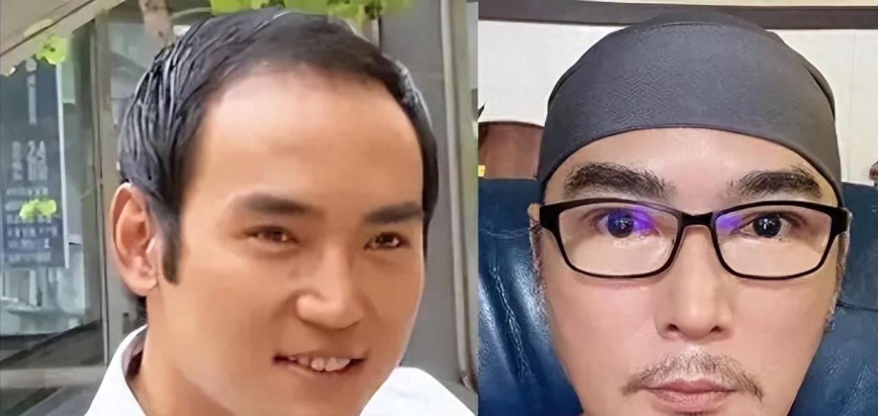 脸部塌方、发腮油腻，这些曾经迷倒万千少女的男神你还记得吗？