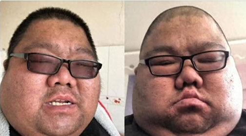 “吃播四巨头”现状：2年没俩，恩克吐血，疯狂吃肉，拒绝减肥