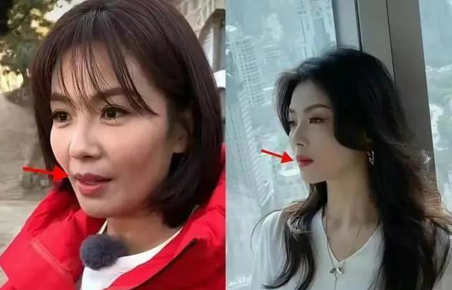 虎牙|半个娱乐圈都做牙，假牙成了潮流，“丑”的千奇百怪一笑就露馅