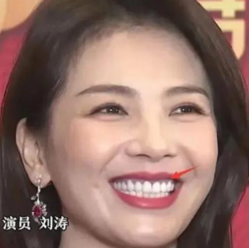 虎牙|半个娱乐圈都做牙，假牙成了潮流，“丑”的千奇百怪一笑就露馅