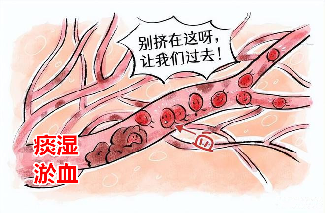 脂肪肝|肚腹肥满脂肪多？赠你一方化痰消浊，赶走脂肪肝 大肚腩 结节包块