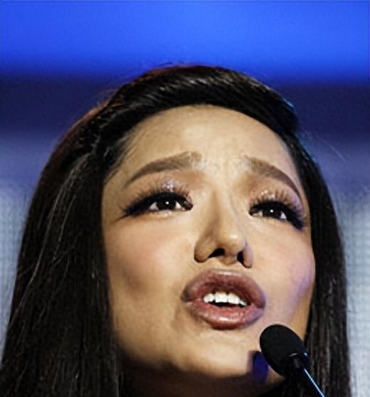 女超冠军江映蓉:因整容失败像“怪物”,全身只剩眼珠是自己的