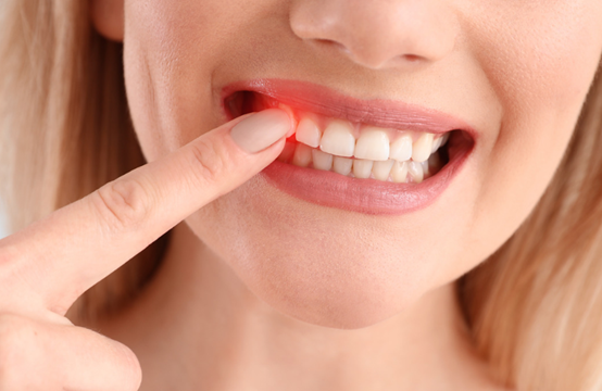 中药|为什么,牙龈出血和口臭“如影随形”?中医:教你一招远离烦恼!