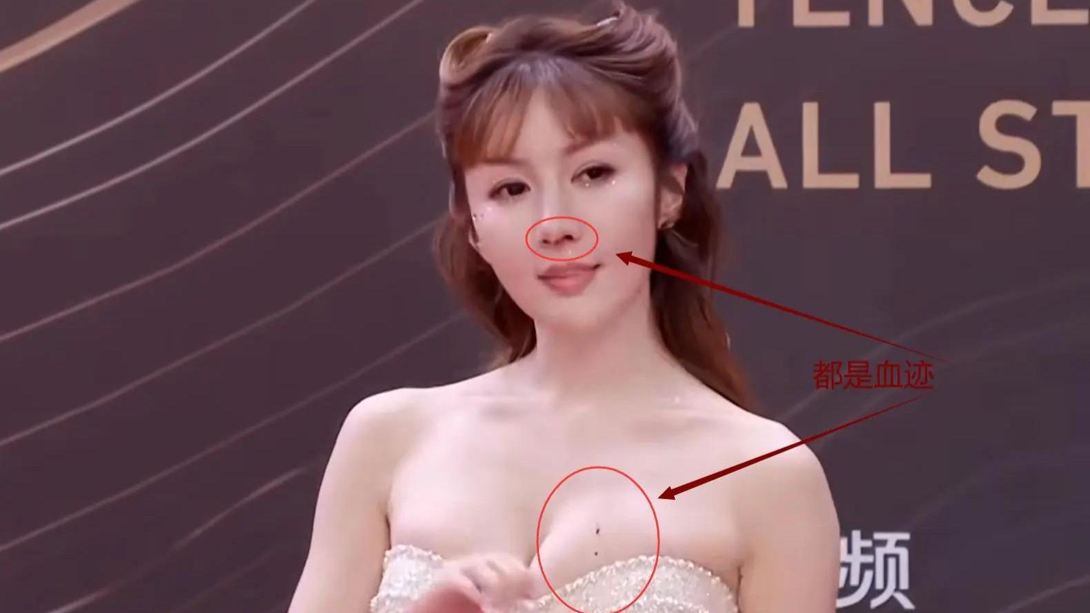 明星大赏名场面！踩箱子垫身高，摔跤流鼻血，抢头条1个比1个抓马