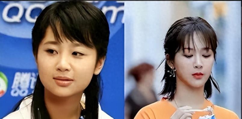 长得“歪瓜裂枣”,整得“美若天仙”,这4位女星全都靠脸逆天改命