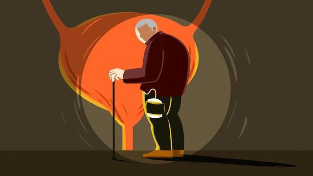 一万人中能有多少人活到80岁?真的越长寿越好?医生坦白真相