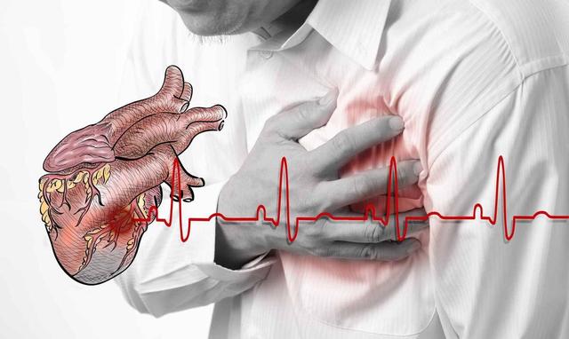 做完冠脉造影，病人就活不久了？医生提醒：这4类人尽量不要尝试