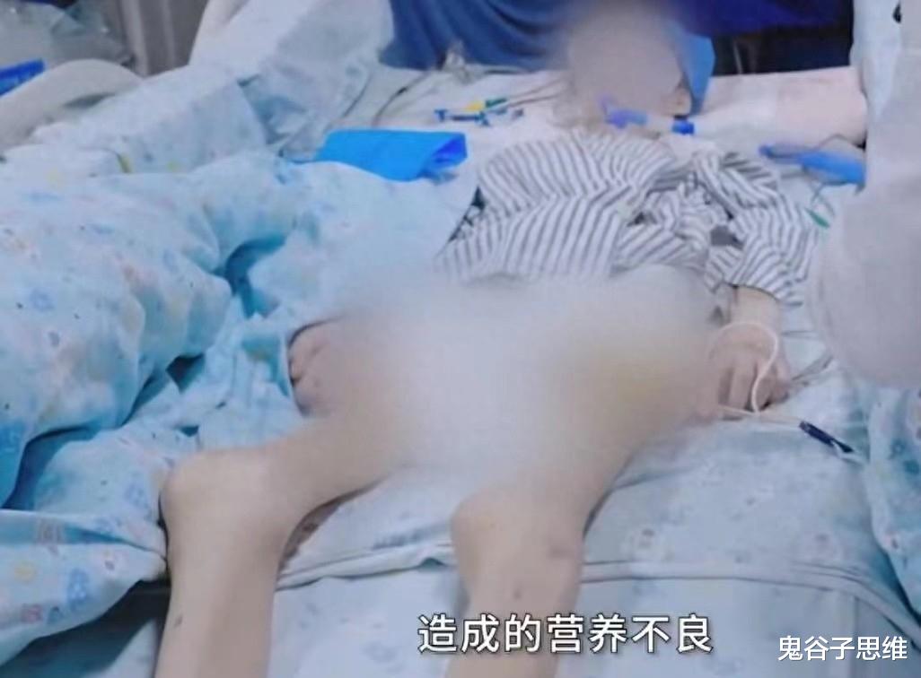 恋爱脑到底有多可怕,身高173的女孩为男友瘦到30公斤,值得吗?