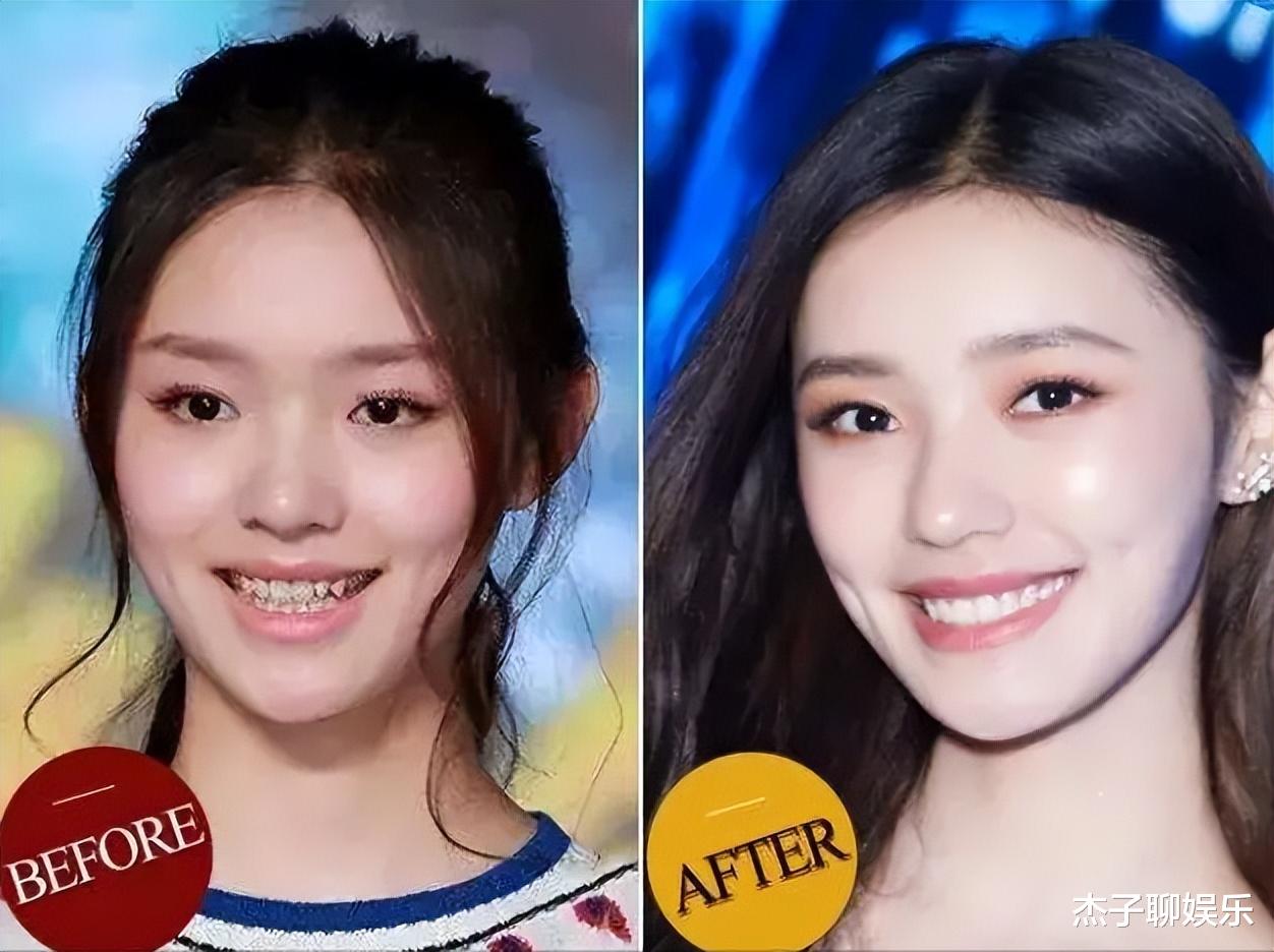 刘亦菲|看了刘亦菲新剧,我庆幸国产剧不再被烤瓷牙、排骨胸“绑架”了