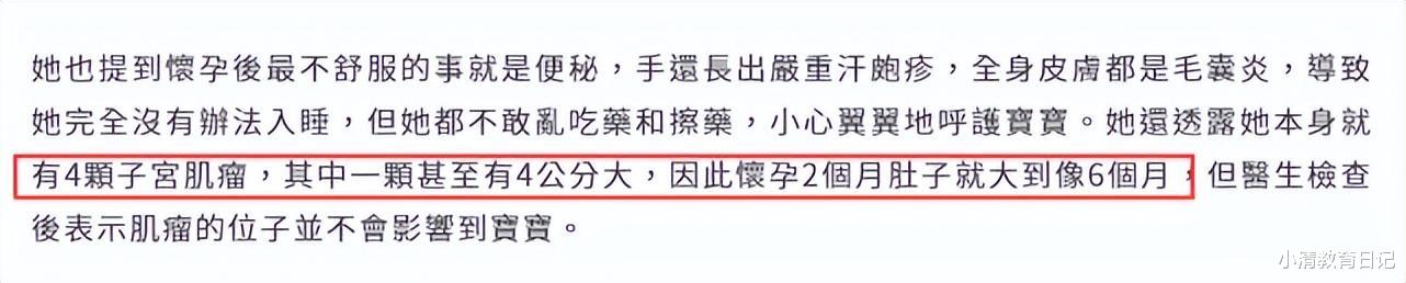 瞬息全宇宙|Selina首晒B超照疑曝光宝宝性别，她因患子宫肌瘤致孕肚格外大