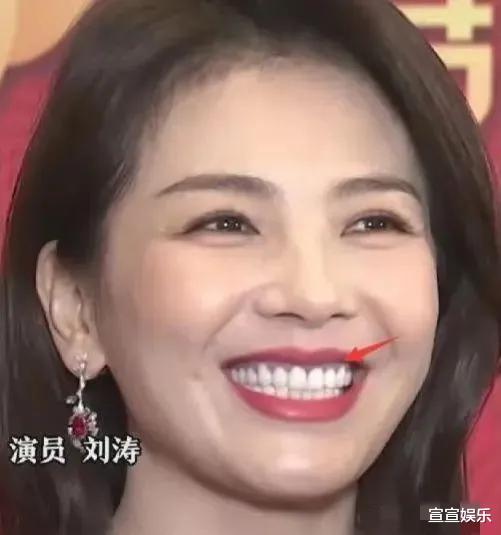 贾静雯|半个娱乐圈都做牙,假牙成了潮流,“丑”的千奇百怪一笑就露馅