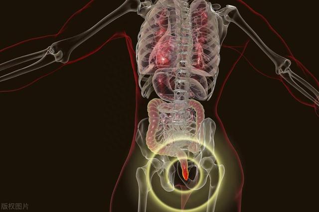 医生：肠道里长了息肉，上厕所时会有3个提示，别等到晚期才知晓