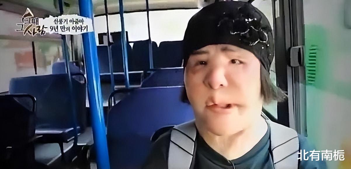 韩国女星整容上瘾注射大豆油,脸部取出8斤异物,最后孤独离世