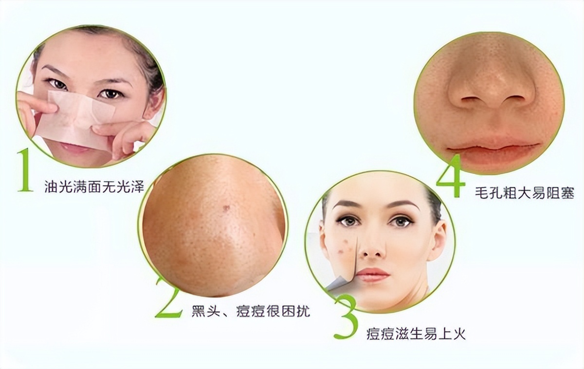 头部爱出汗，一吃饭更是汗如雨下？送你一方，清热利湿，专治头汗