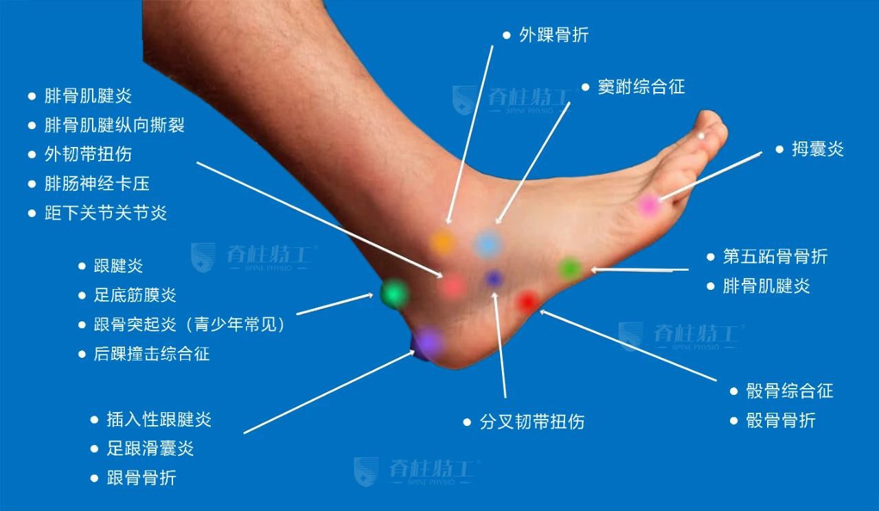 4张脚痛地图,教你自查55种病痛!