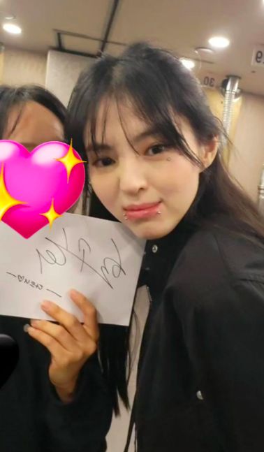 韩素希与粉丝合影,眼钉唇钉很多,丝毫不避讳,头发稀疏发缝明显