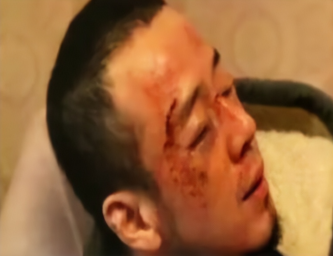 50岁杨坤被打后，外界叫好声不断，网友身上的戾气从哪里来？