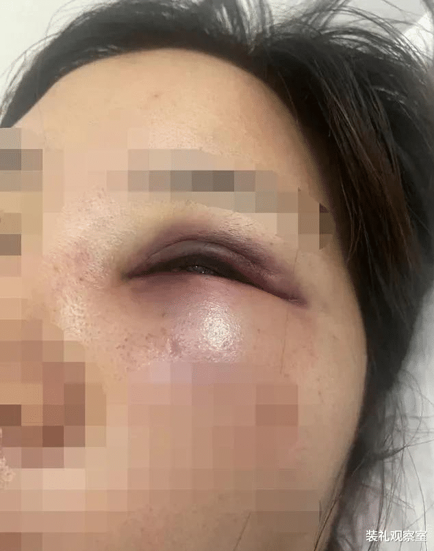 看病|国外高薪招聘黑幕！西港比缅北更恐怖，90后女孩用亲身经历道实情