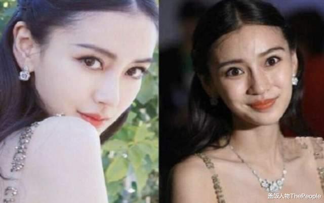 Angelababy|诡异微笑唇、肿胀苹果肌，“为国争光”的神颜崩了，她该何去何从