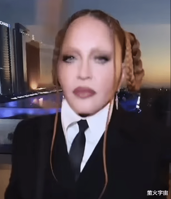 麦当娜|64岁麦当娜亮相格莱美，整容痕迹过重、面目全非：这胖姑娘是谁