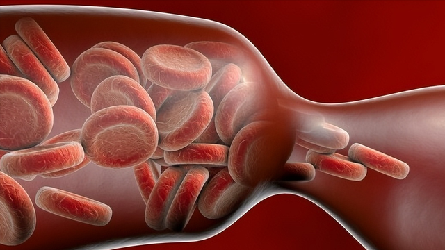 健身|血栓来临，腿部先知？腿上出现3种异常，或是血栓已经形成