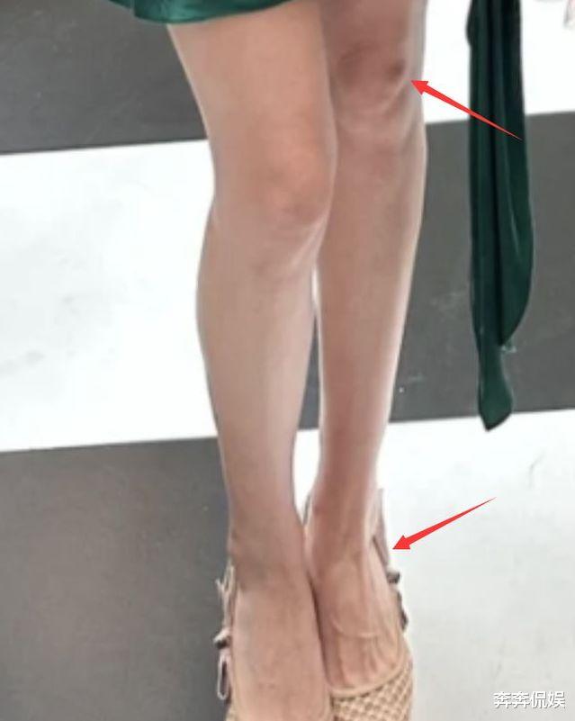 |张馨予喝下午茶被偶遇,肩膀壮实膝盖淤青明显,被指没有素人好看