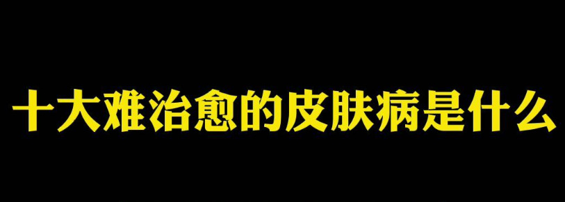 盘点十大难治愈的皮肤病!引发绝望的源泉!