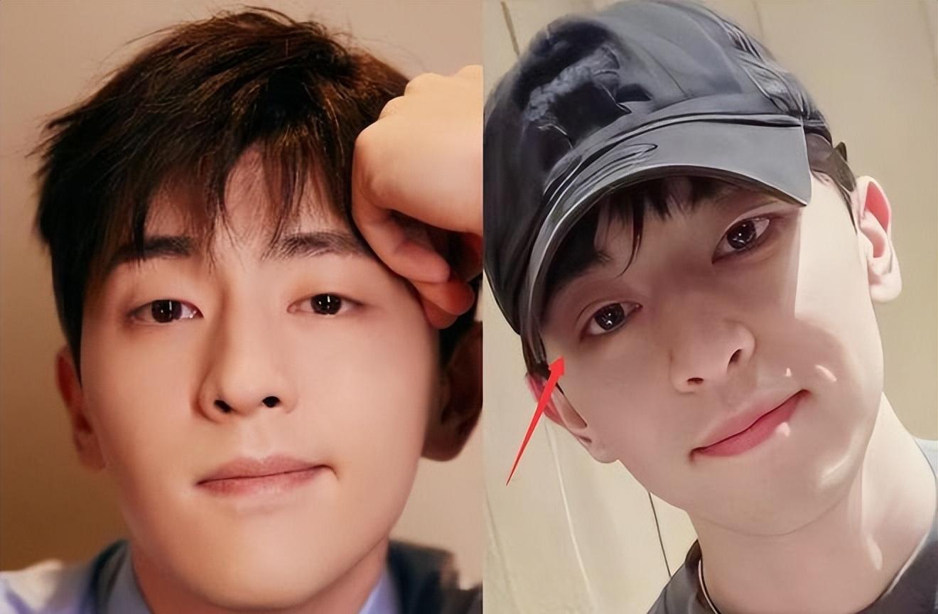 邓伦|邓伦近照大变样，疑整容变双眼皮，与圈内明星一起参加婚礼成焦点