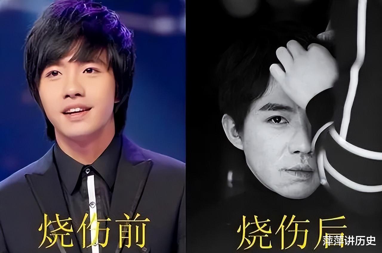 7位死里逃生的明星,本以为会因意外销声匿迹,如今个个大红大紫