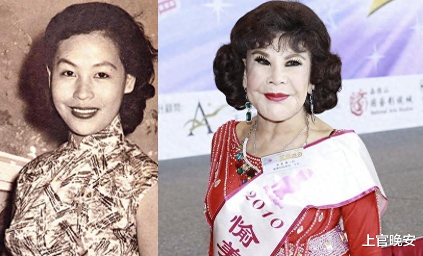 越整越难看后遗症一堆的9位女星!脸像鞋拔子,笑比哭难看