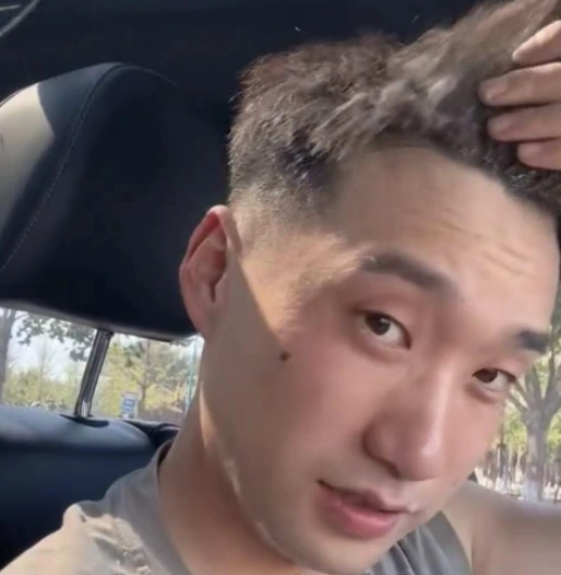 粉底液 女子和男友外出，粉底液晒爆皮，一脸妆容不忍直视，网友：这是新式妆容？