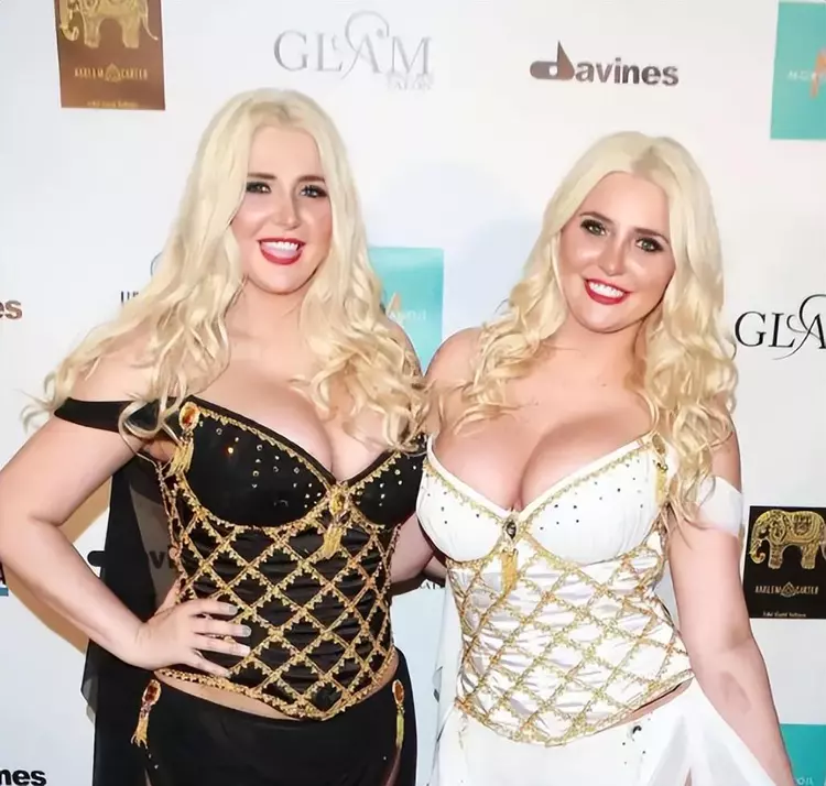 双胞胎兔女郎:18岁被花花公子赫夫纳相中,一年后抛弃,32岁爆肥