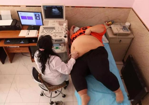 美女校花被丈夫喂到330斤,还睡塌两张床,丈夫:怕她被人抢走