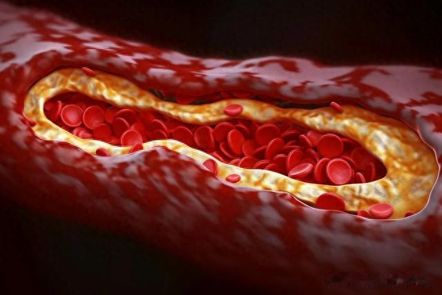 两味药，久服，可消融腹中一切积聚