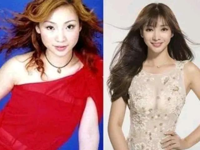 整容|长得“歪瓜裂枣”,整得“如花似玉”,这些女星都靠脸逆天改命
