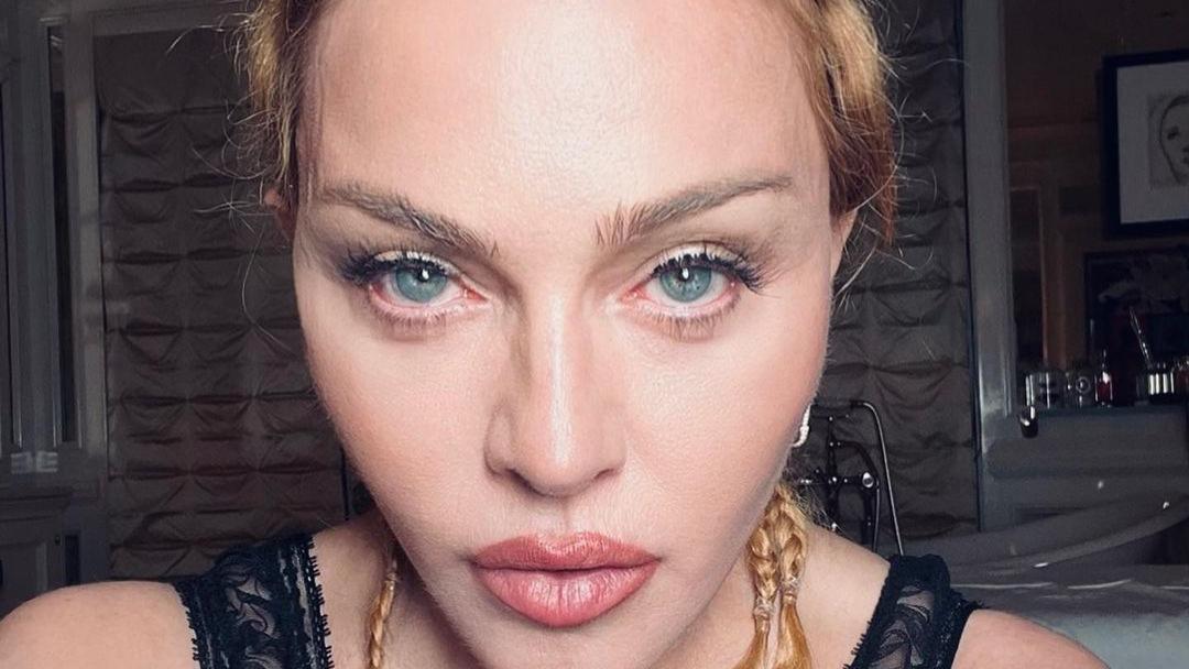 64岁麦当娜因细菌感染入住ICU并接受插管治疗，经纪人发布声明