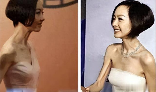 瘦到病态、动脸成瘾、切胃、剪肠齐上阵，内娱畸形审美真可怕！