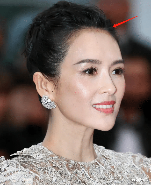 赵丽颖的毛孔，宋轶的黑头，没了滤镜这些明星彻底“暴露”了