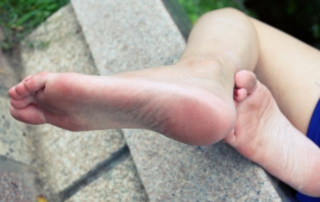 |脚后跟经常“开裂”是怎么回事?或与6个原因有关,早做了解