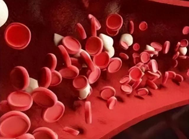 血液“稀释剂”被发现,柠檬水落榜,医生:坚持喝血管变通透